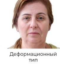 Деформационный